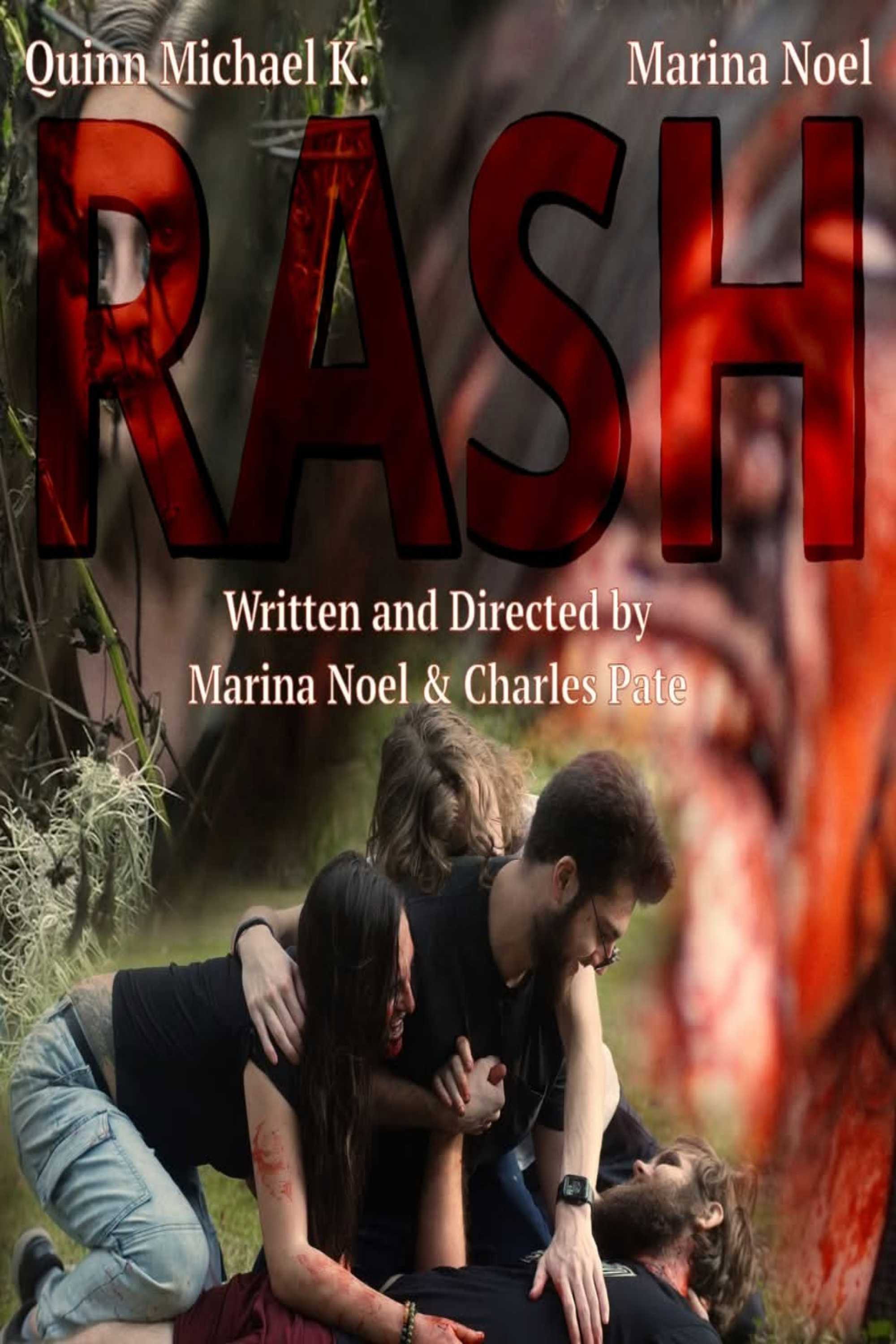 Rash